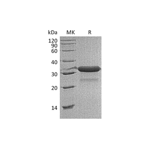 重组小鼠IGFBP-7 (C-6His)蛋白,Recombinant Mouse IGFBP-7 (C-6His)