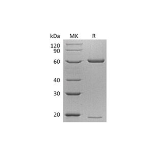 重组小鼠PCSK9 (C-6His)蛋白,Recombinant Mouse PCSK9 (C-6His)