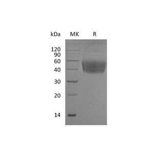 重组小鼠B7-1 (C-6His)蛋白,Recombinant Mouse B7-1 (C-6His)