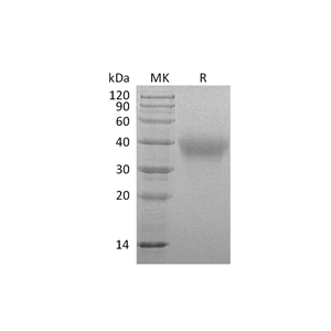 重组绒猴TIM-3 (C-6His)蛋白,Recombinant Marmoset TIM-3 (C-6His)