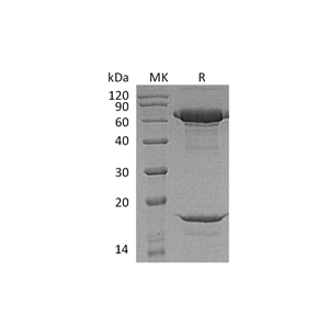 重组豚尾猴PCSK9 (C-6His)蛋白,Recombinant Macaca nemestrina PCSK9 (C-6His)