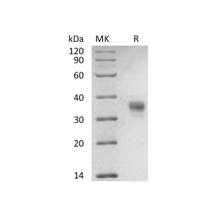 重组食蟹猴LILRB4 (C-6His)蛋白,Recombinant Cynomolgus LILRB4 (C-6His)