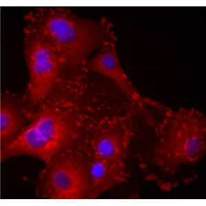 小鼠内脏脂肪细胞,Mouse visceral adipocytes