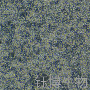 MyC-CaP（小鼠前列腺癌细胞）YB-7056MC