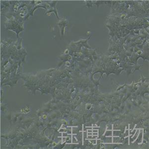 KYSE-140（人食管鳞状细胞癌）YB-71893HC