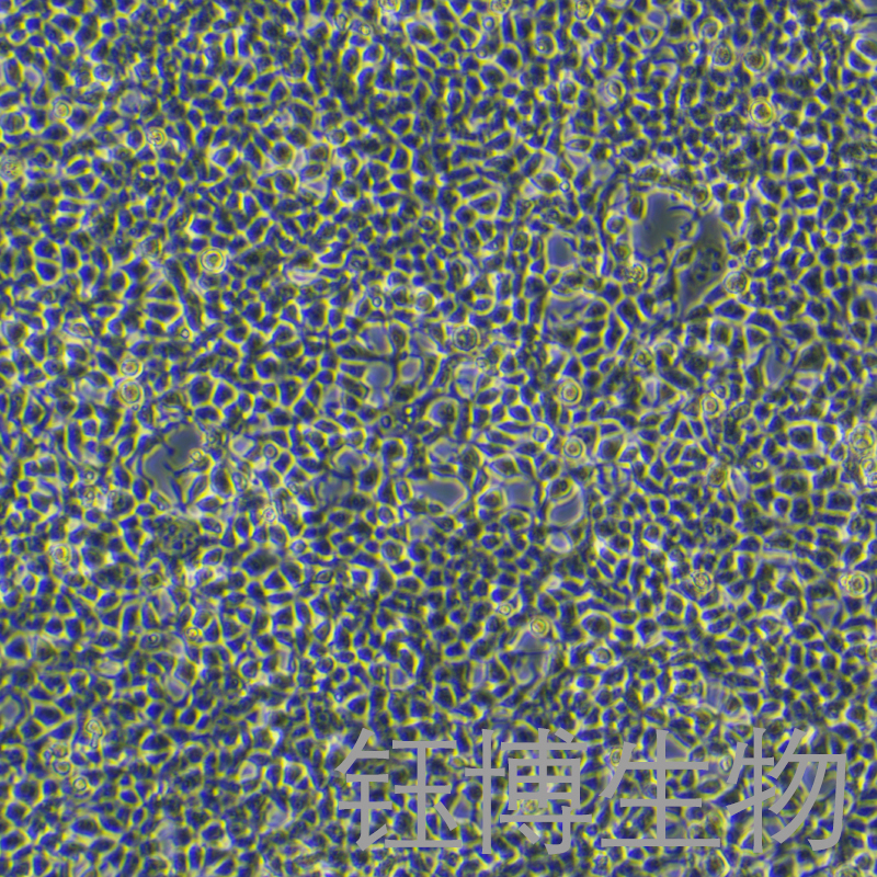 Plat-E（人逆转录病毒包装细胞 293亚型）YB-71913HC,Plat-E