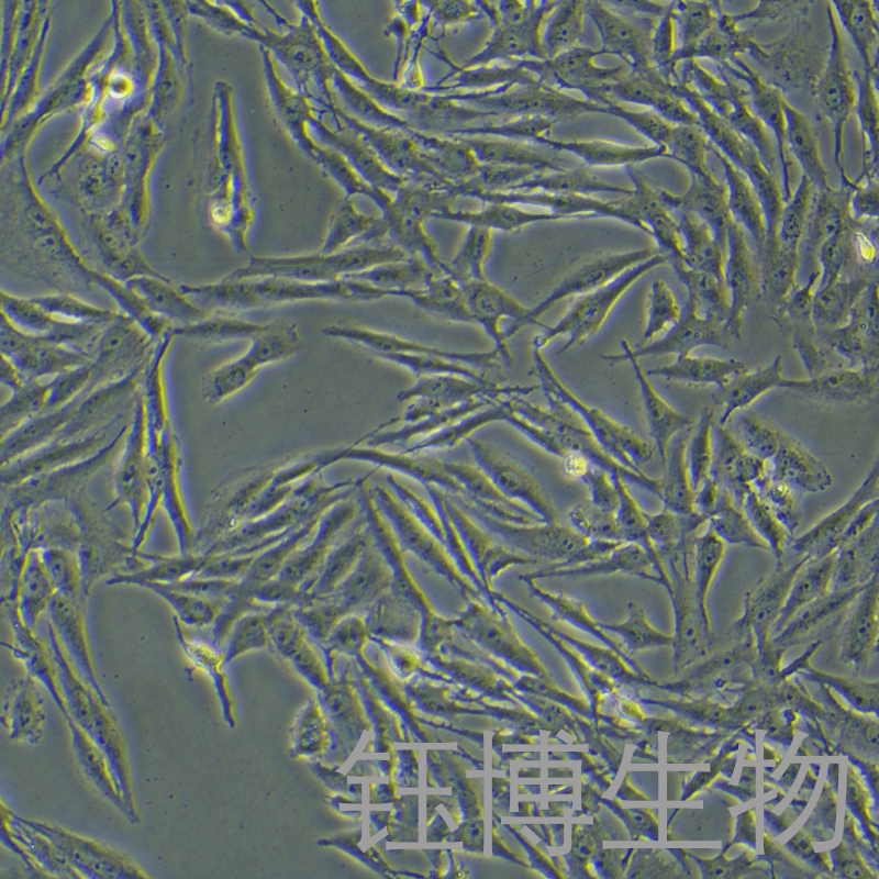 U251 MG/TMZ（人类星形胶质瘤耐替莫唑胺细胞）YB-71940HC,U251 MG/TMZ