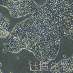 LC-2/AD（人肺癌腺癌细胞）YB-71910HC