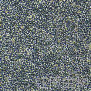 Plat-E（人逆转录病毒包装细胞 293亚型）YB-71913HC,Plat-E