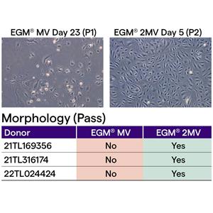 EGM-2-MV 内皮细胞培养基套装（CC-3156 & CC-4147）,EGM-2 MV BulletKit (CC-3156 & CC-4147)