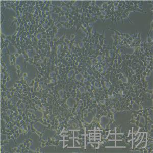 Phoenix-ECO（人逆转录病毒包装细胞系）YB-71955HC