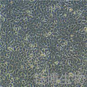 KYSE-450（人食管鳞癌细胞）YB-71956HC