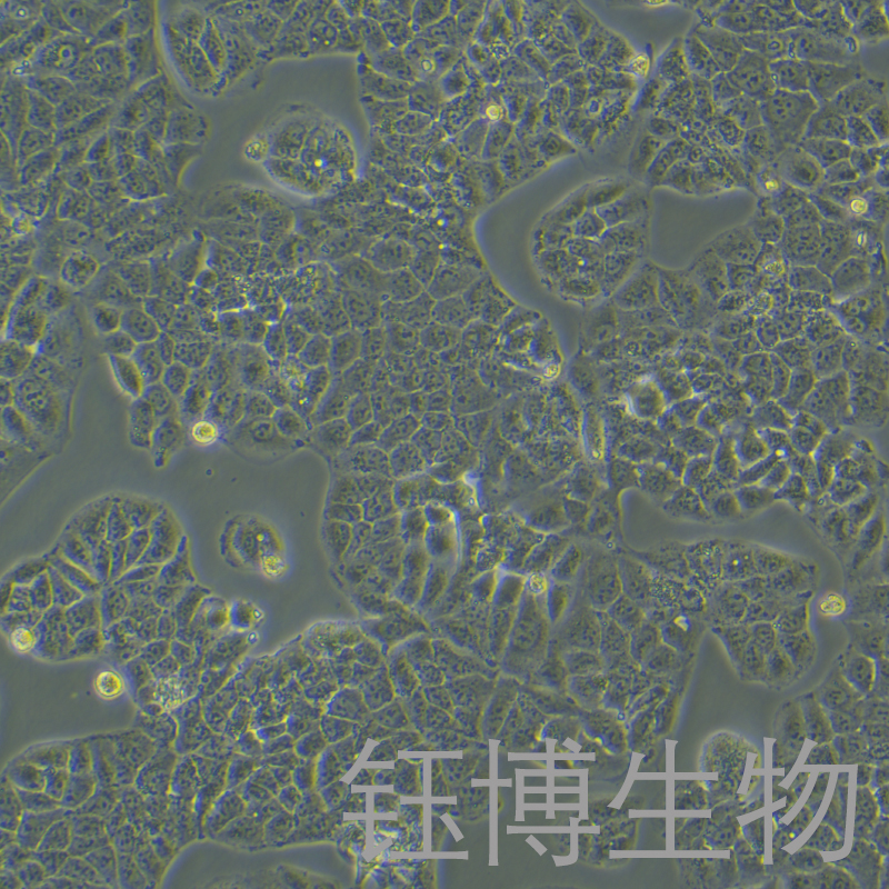 Huh-1（人肝癌细胞）YB-71981HC,Huh-1