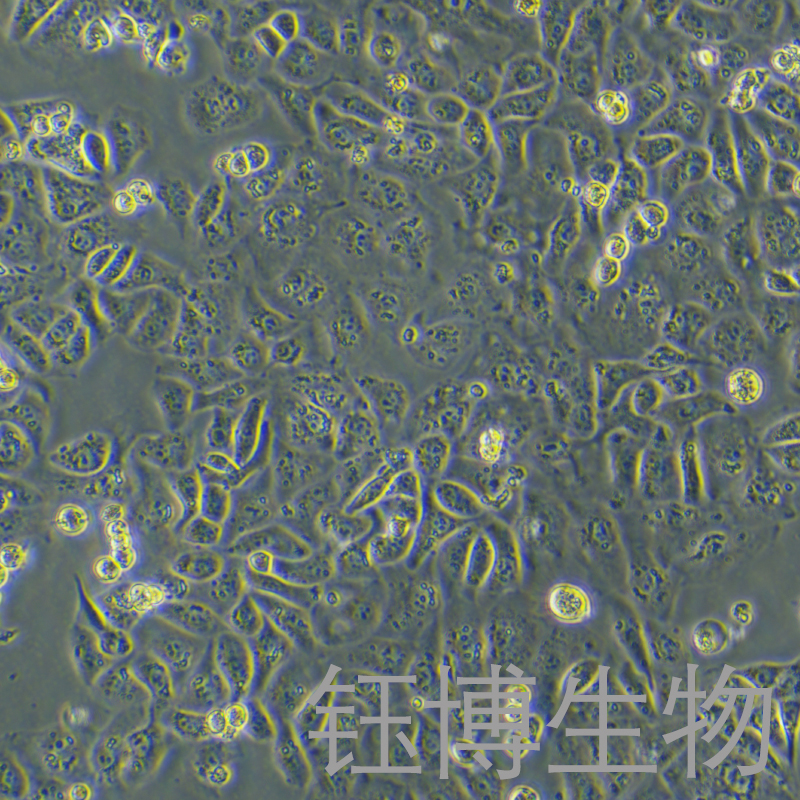 IGROV-1（人卵巢癌细胞/卵巢子宫内膜样腺癌）YB-71987HC,IGROV-1