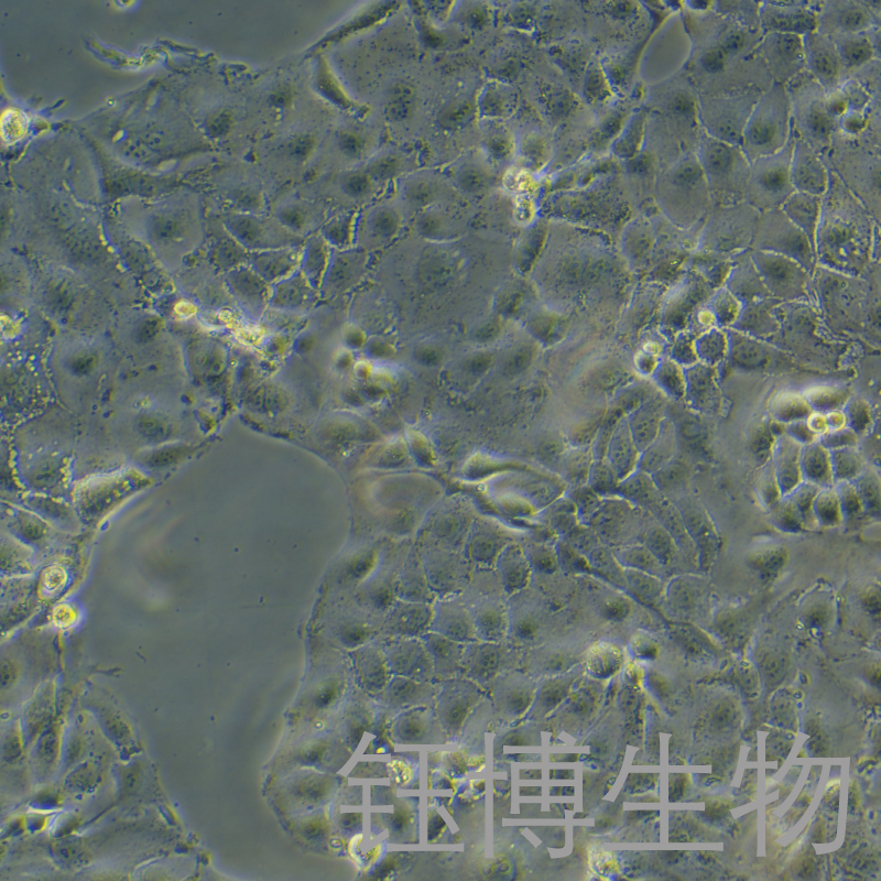 OAW28（人卵巢上皮性肿瘤细胞）YB-71990HC,OAW28