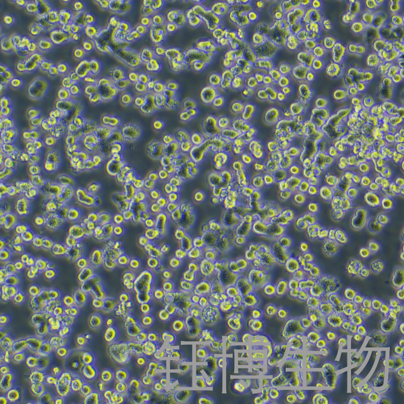 COLO 678（人结肠癌细胞细胞）YB-71988HC,COLO 678