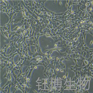 HCC1395（人乳腺癌细胞 （三阴性））YB-71979HC