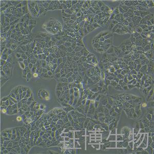 Huh-1（人肝癌细胞）YB-71981HC,Huh-1