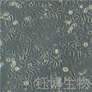 IGROV-1（人卵巢癌细胞/卵巢子宫内膜样腺癌）YB-71987HC