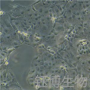 OAW28（人卵巢上皮性肿瘤细胞）YB-71990HC