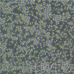 EOL-1（人嗜酸性粒细胞白血病细胞株）YB-72007HC