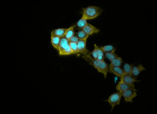 SD大鼠肺成纤维细胞,SD rat pulmonary fibroblasts