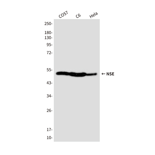 NSE (4C7)鼠单抗,NSE (4C7) Mouse Monoclonal Antibody