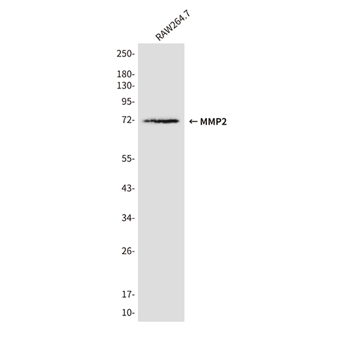 MMP2 (3A8)鼠单抗,MMP2 (3A8) Mouse Monoclonal Antibody