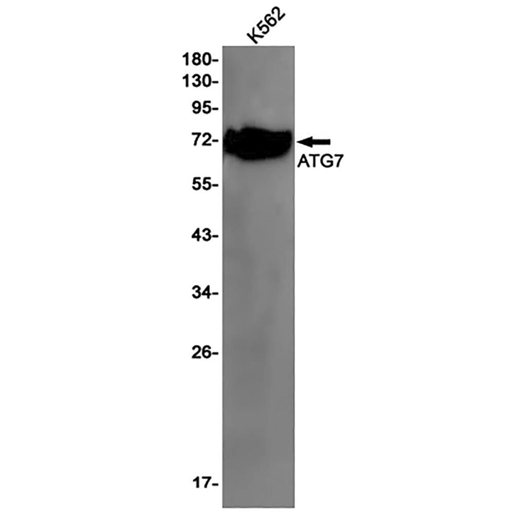 ATG7兔单抗,ATG7 Rabbit Monoclonal Antibody