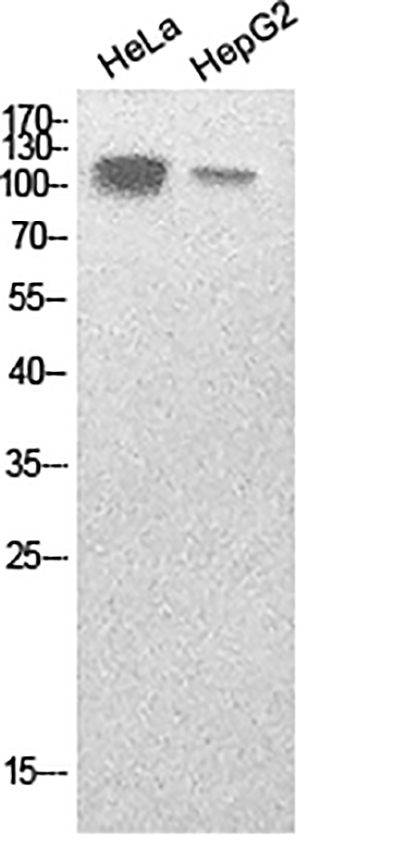 SREBP1兔多抗,SREBP1 Rabbit Polyclonal Antibody