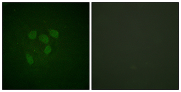 Acetyl p53 (K319)兔多抗,Acetyl p53 (K319) Rabbit Polyclonal Antibody