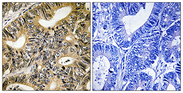 4E-BP1 (phospho Thr70)兔多抗,4E-BP1 (phospho Thr70) Rabbit Polyclonal Antibody