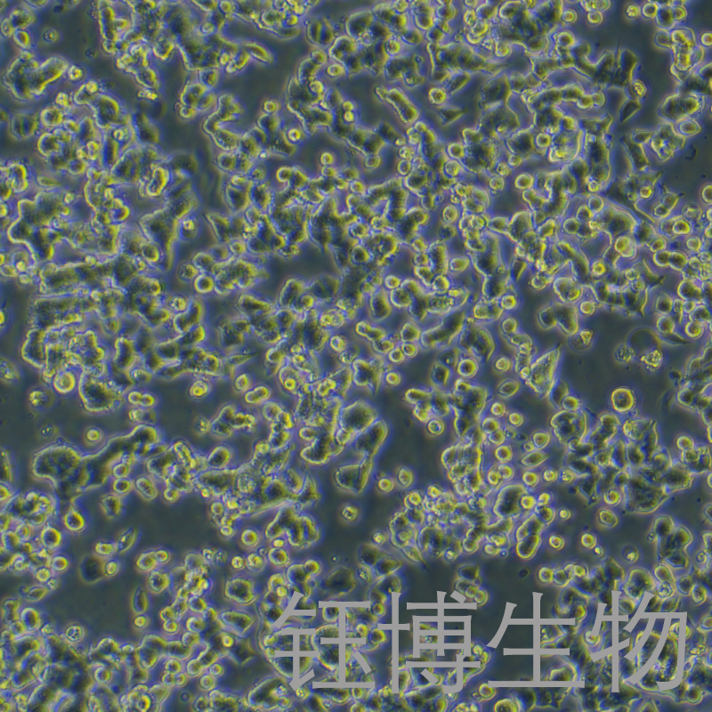 NCI-H810（人非小细胞肺癌细胞）YB-72022HC,NCI-H810