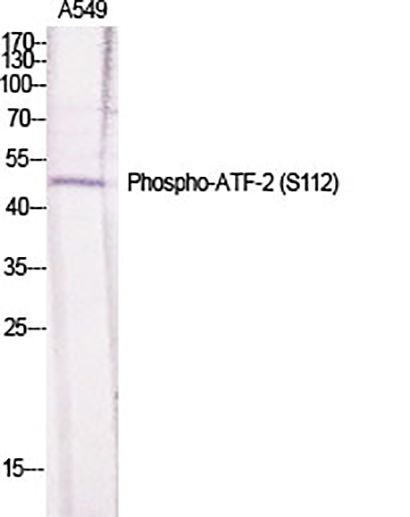ATF-2 (phospho Ser112)兔多抗,ATF-2 (phospho Ser112) Rabbit Polyclonal Antibody