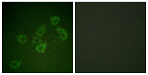 Caspase-6 (phospho Ser257)兔多抗,Caspase-6 (phospho Ser257) Rabbit Polyclonal Antibody