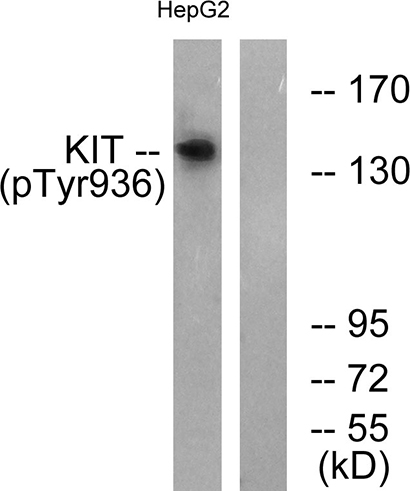 c-Kit (phospho Tyr936)兔多抗,c-Kit (phospho Tyr936) Rabbit Polyclonal Antibody
