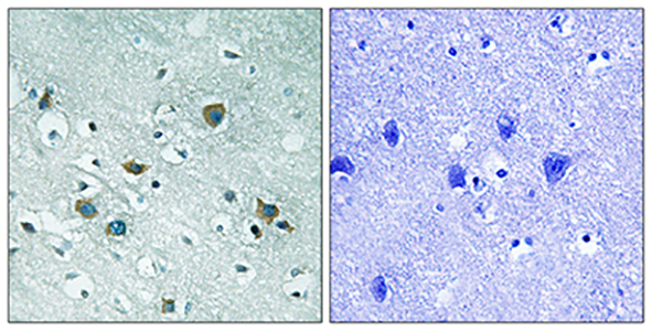 CRMP-2 (phospho Thr509)兔多抗,CRMP-2 (phospho Thr509) Rabbit Polyclonal Antibody