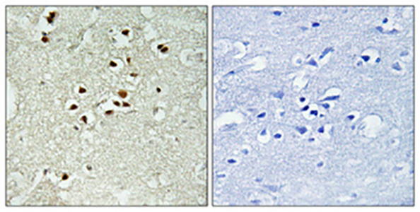 DNA Ligase IV (phospho Thr650)兔多抗,DNA Ligase IV (phospho Thr650) Rabbit Polyclonal Antibody