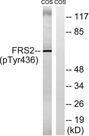 FRS2 (phospho Tyr436)兔多抗,FRS2 (phospho Tyr436) Rabbit Polyclonal Antibody