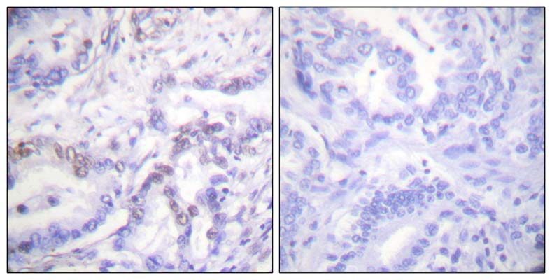 Histone H3 (phospho Thr3)兔多抗,Histone H3 (phospho Thr3) Rabbit Polyclonal Antibody