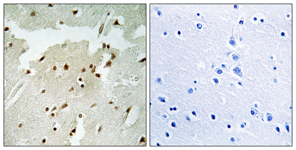 Ku-70 (phospho Ser5)兔多抗,Ku-70 (phospho Ser5) Rabbit Polyclonal Antibody