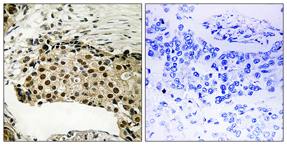 MSK1 (phospho Ser212)兔多抗,MSK1 (phospho Ser212) Rabbit Polyclonal Antibody