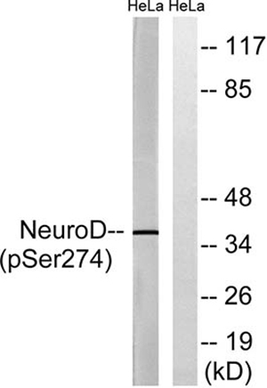 Neuro D (phospho Ser274)兔多抗,Neuro D (phospho Ser274) Rabbit Polyclonal Antibody