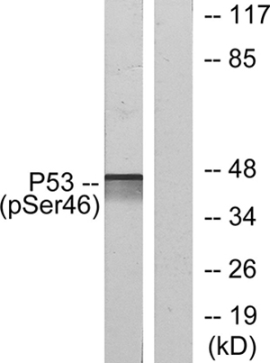 p53 (phospho Ser46)兔多抗,p53 (phospho Ser46) Rabbit Polyclonal Antibody