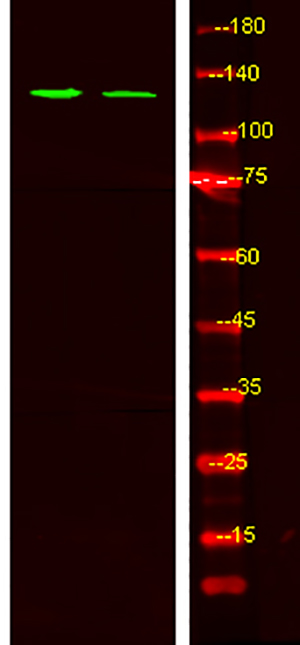 Tie2 (phospho-Ser1119)兔多抗,Tie2 (phospho-Ser1119) Rabbit Polyclonal Antibody