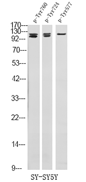 FGFR3 (Phospho-Tyr724)兔多抗,FGFR3 (Phospho-Tyr724) Rabbit Polyclonal Antibody