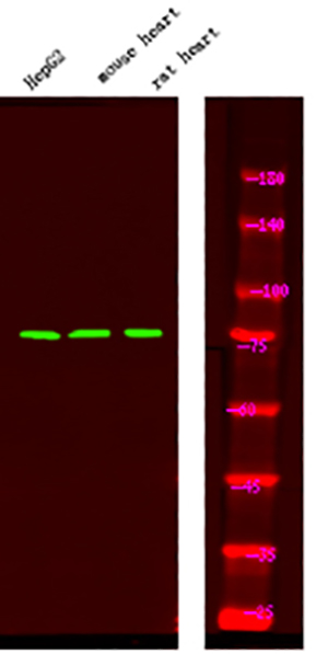 FKHR (Phospho-Ser249)兔多抗,FKHR (Phospho-Ser249) Rabbit Polyclonal Antibody