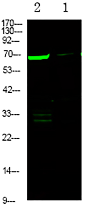 L-plastin (Phospho-Ser5)兔多抗,L-plastin (Phospho-Ser5) Rabbit Polyclonal Antibody