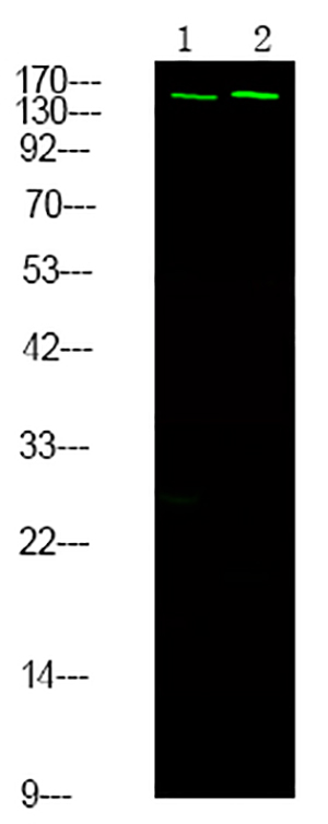 NCoA3 (Phospho-Ser857)兔多抗,NCoA3 (Phospho-Ser857) Rabbit Polyclonal Antibody