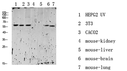 RIPK2 (Phospho-Ser176)兔多抗,RIPK2 (Phospho-Ser176) Rabbit Polyclonal Antibody
